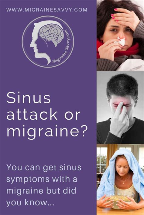 Sinus Migraines How To Treat Them Effectively Sinus Migraine