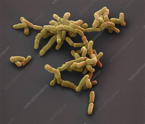 Bifidobacterium Bacteria Sem Stock Image C0290319 Science Photo