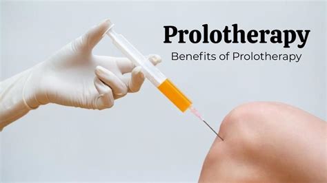 Benefits Of Prolotherapy Treatment The Prolotherapy Clinic