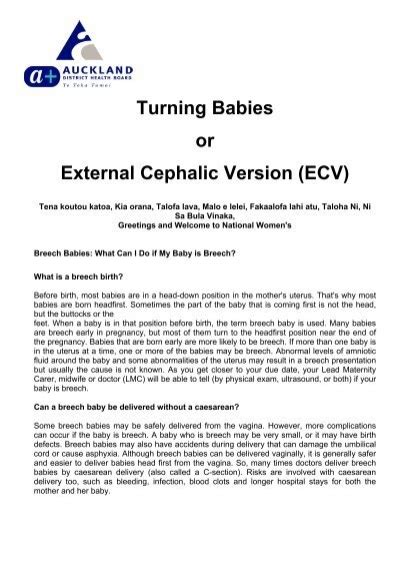 Turning Babies Or External Cephalic Version National Womens