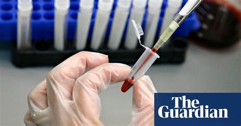 Hiv Specialists Take Stock After Virus Reappears In Cured Girl Aids