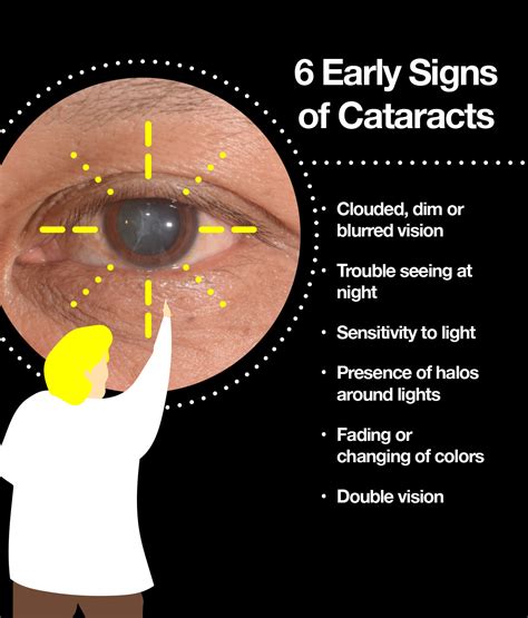 What Causes Cataracts Information On Symptoms Different Types The