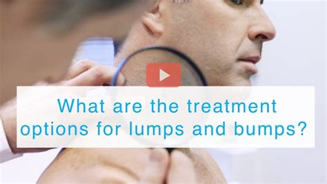 Eyelid Lumps And Bumps Clinica London