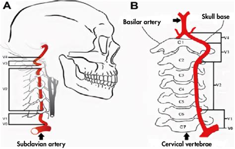 Anatomical View Of The Path Of The Lateral A And Anterior B
