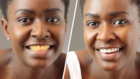 How I Whiten My Yellow Teeth Naturally And Nstant At Home In Just 2