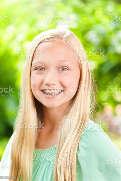 Лига домохозяек 4 сезон 14 серия. Young Caucasian Teen Girl Portrait With Dental Teeth Braces Stock Photo & More Pictures of 12-13 ...
