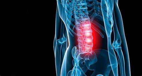 Остеохондроз поясничный диета Остеохондроз поясничного отдела - диагностика и лечение в 100med Остеохондроз поясничного отдела - диагностика и лечение в 100med Остеохондроз поясничный диета
