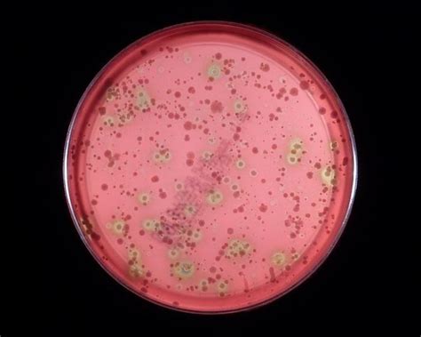 Streptococcus viridans характеристика возбудителя и инфекции