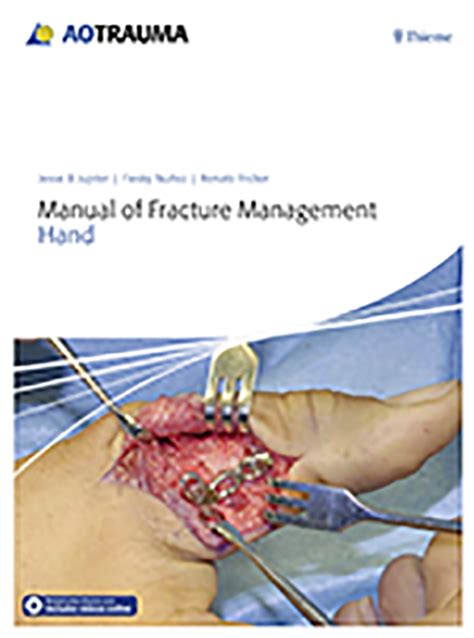Manual Of Fracture Management Hand Opnews