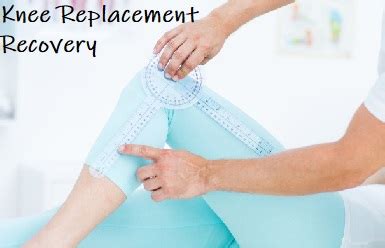 Knee Replacement Recovery Time Guide Knee Pain Explained