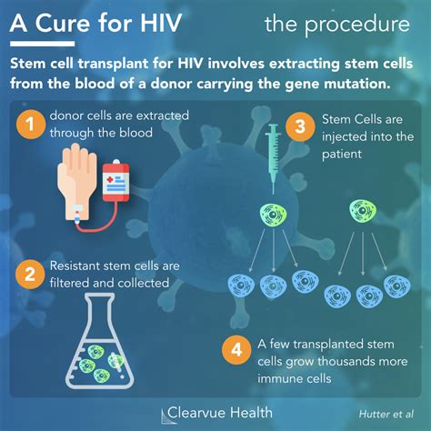 ELI5 How The HIV Stem Cell Cure Works Health Visualized