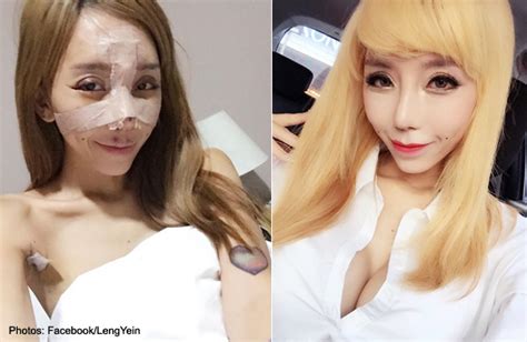 malaysian dj leng yein unveils new look after plastic surgeries in korea health health news