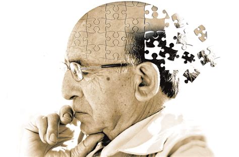 ¿cuáles Son Los Síntomas Iniciales De La Enfermedad De Alzheimer