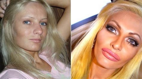 Model Spends Thousands On Plastic Surgery To Look Like A Sex Doll Says