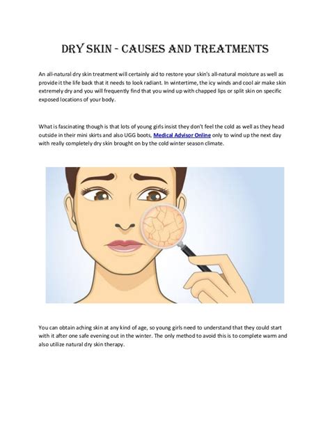 Dry Skin Causes And Treatments
