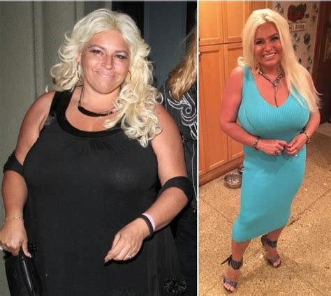 Beth Chapman Weight Loss Cancer
