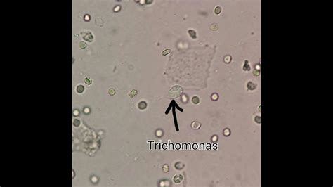 Trichomonas Microscope