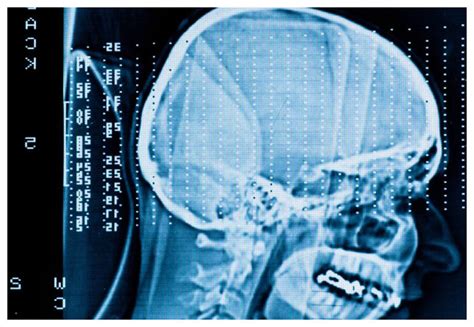 Could Brain Scans Id Potential Criminals Science And Technology