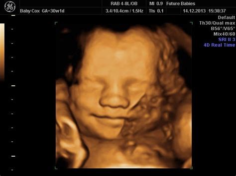 3d Image Of A Baby At 30 Weeks Gestation Ultrasound Pictures 4d