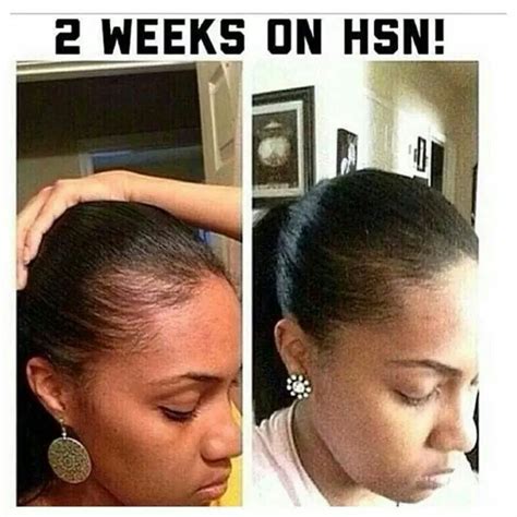I'd rather live until i'm 100 and be bald, than die at 18 before my hair goes out; Hair thinning? Falling out? To short? Then you have to try ...