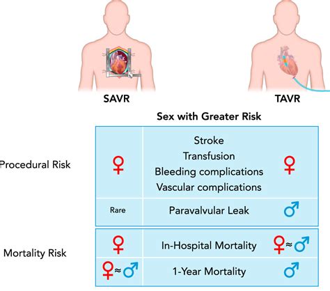 Pathophysiology Of Aortic Valve Stenosis Is It Both Fibrocalcific And Sex Specific Physiology