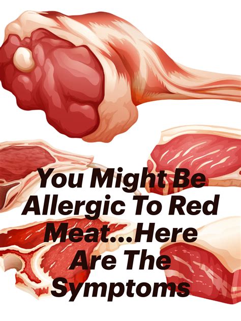 Pin On Alpha Gal Red Meat And Mammal Food Allergy