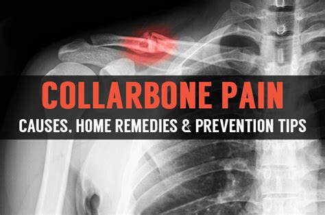 Never Ignore Collarbone Pain Or Injuries If Hurt Longer