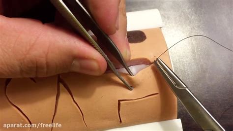 Subcuticular Suture Step By Step Instruction In Hd