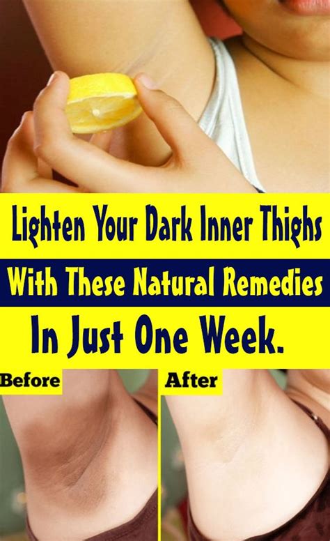 How To Lighten Dark Inner Thigh But And Bikini Area In Natural