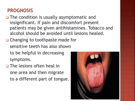 Ppt Tongue Disorders Powerpoint Presentation Free Download Id5698769