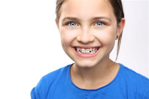 Ortodoncia En Niños ¿cuándo Es Necesaria Y Qué Debemos Saber Estudi