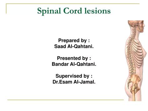Ppt Spinal Cord Lesions Powerpoint Presentation Free Download Id