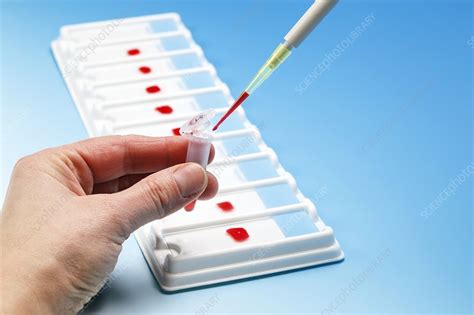 Blood Sample Stock Image F0090774 Science Photo Library