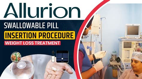 allurion gastric balloon live swallow pill weight loss balloon patient review before and