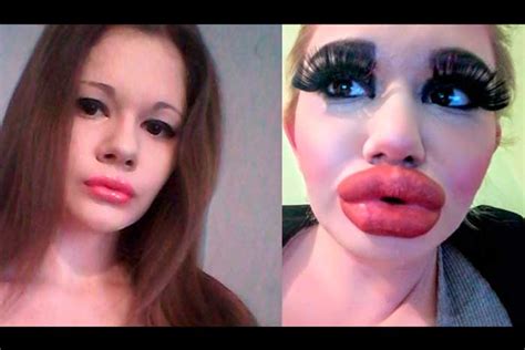 Biggest Lips In The World Images