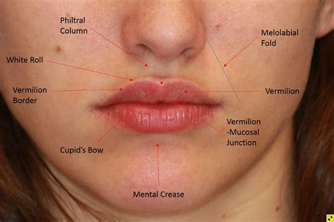 Lip Reconstruction Using The Sabattini Abbé Cross Lip Flap Operative