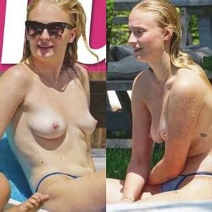 Sophie Turner Nude Topless Sunbathing Photos