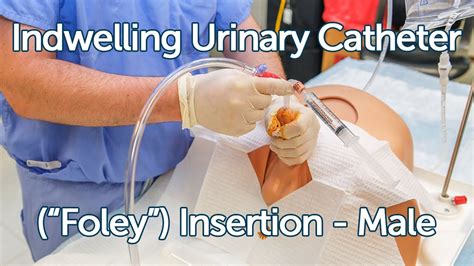 Indwelling Urinary Catheter Foley Insertion Male Youtube