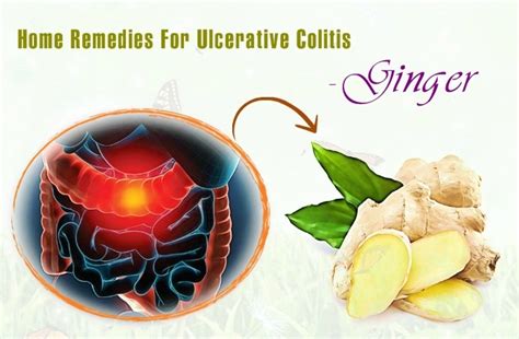 25 Home Remedies For Ulcerative Colitis Symptoms