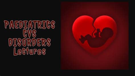 Cvs Paediatrics Lecture 9 Infective Endocarditis Made Simple Youtube
