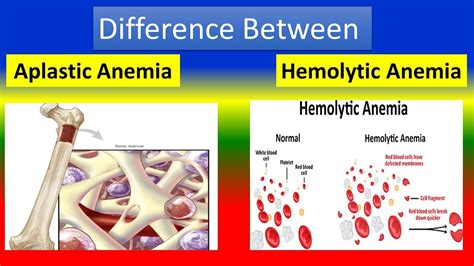 Different Between Aplastic Anemia And Hemolytic Anemia Youtube