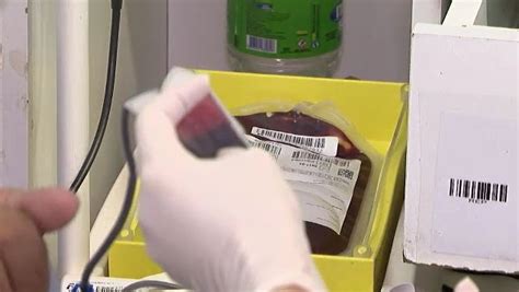 Criança é Infectada Com Vírus Hiv Após Transfusão De Sangue E Hemoacre