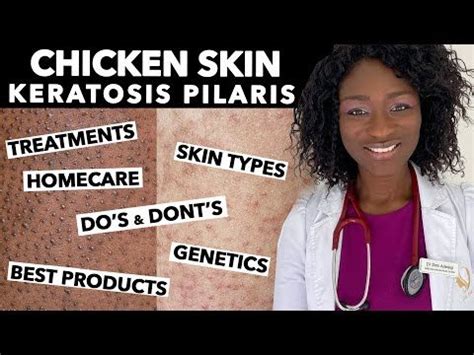 Keratosis Pilaris Chicken Skin Treating Dry Bumpy Skin Special Tips For Black Skin Ask