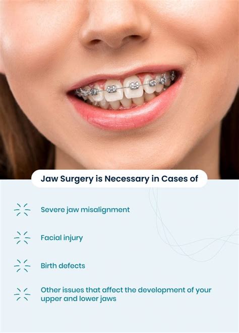 Jaw Surgery For Overbite Cost Recovery And More 2023
