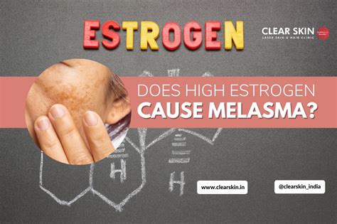 Debunking The Myth Does High Estrogen Cause Melasma