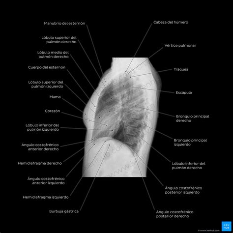 Anatomía Radiológica Rayos X Tac Rm Kenhub