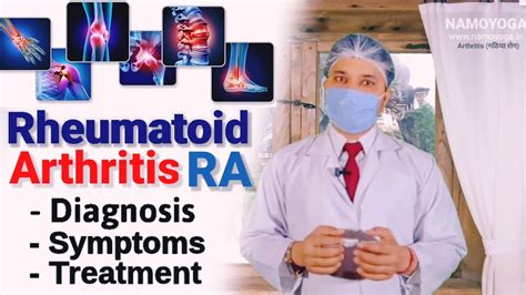 Rheumatoid Arthritis Symptoms Causes And Treatment 13350 Hot Sex Picture
