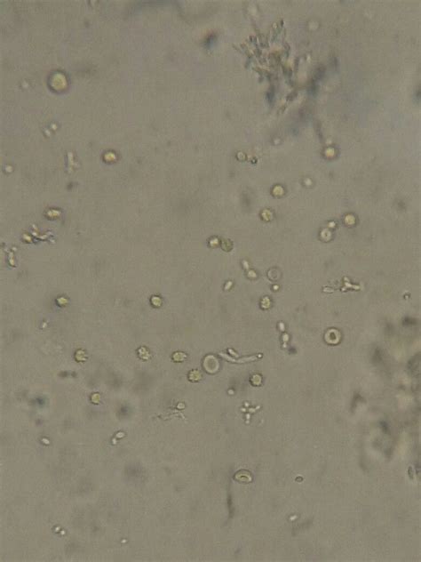 Yeast Cells Under Microscope 40x Micropedia