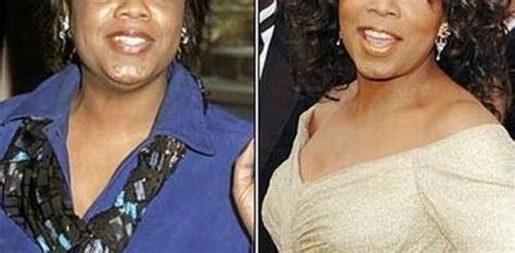 Oprah Winfrey Nose Job Surgery Before And After Photos