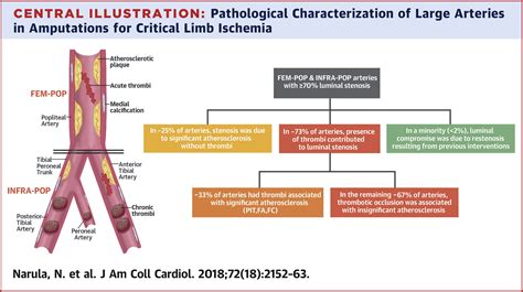 Pathology Of Peripheral Artery Disease In Patients With Critical Limb Ischemia Journal Of The